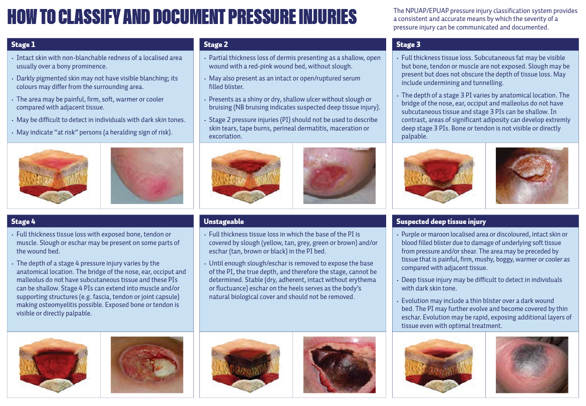 Figure From Development Of An Evidence based Pressure Ulcer 58 OFF