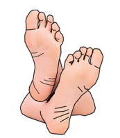 The Diabetic Foot - Auckland